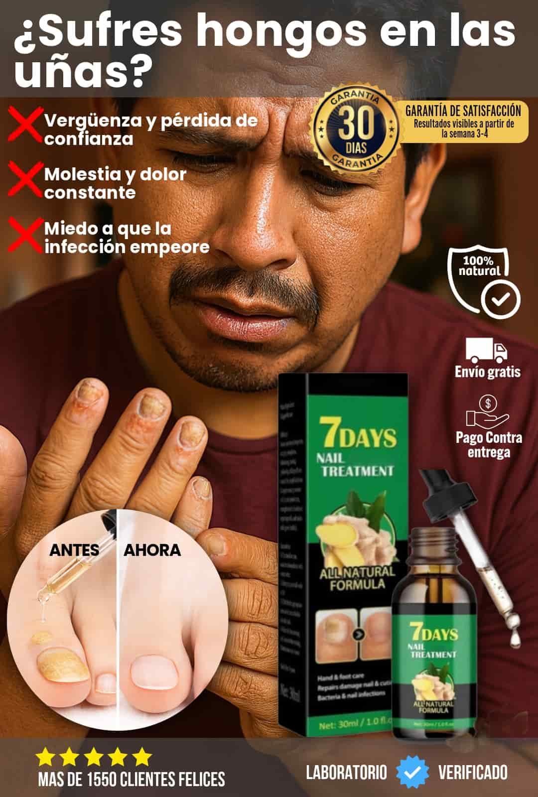 TRATAMIENTO UÑAS CON HONGOS