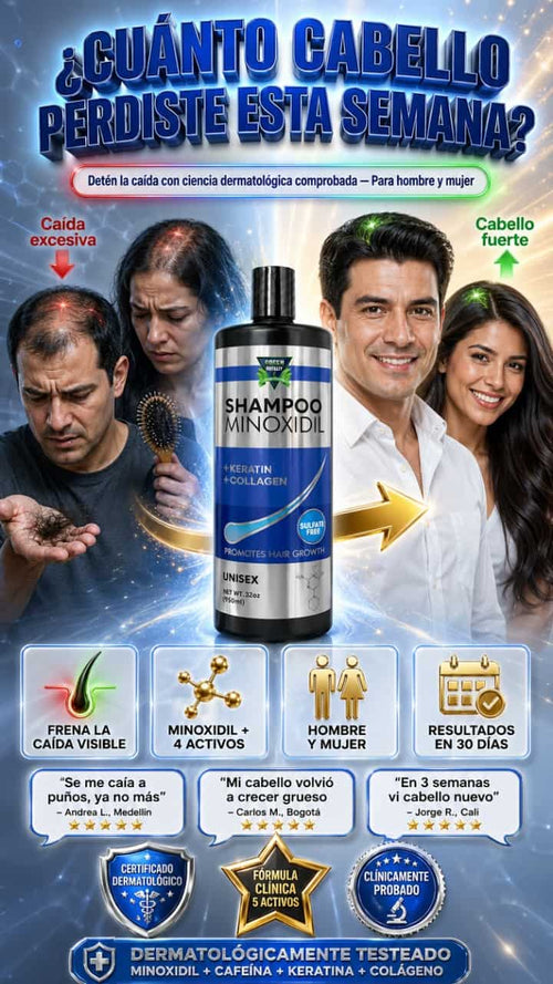 MINOXIDIL FORTALEZA TU PELO Y EVITA LA CAIDA