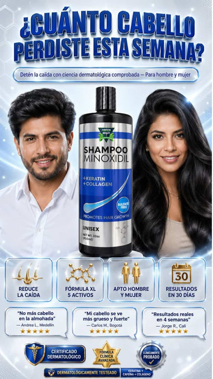 MINOXIDIL FORTALEZA TU PELO Y EVITA LA CAIDA
