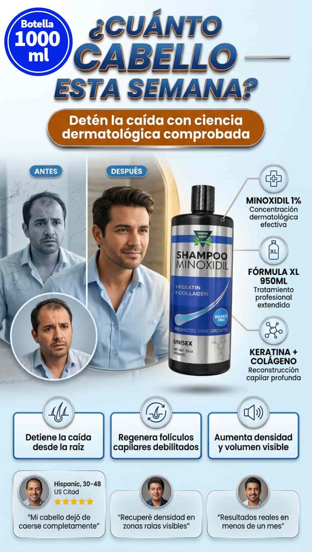 MINOXIDIL FORTALEZA TU PELO Y EVITA LA CAIDA